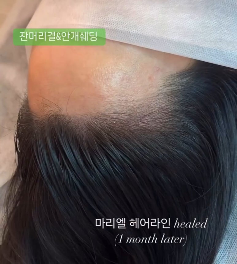마리엘헤어 이미지