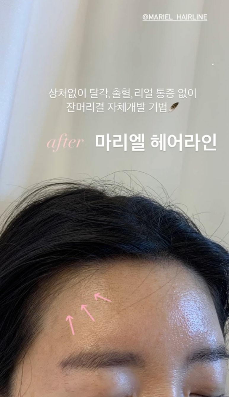 마리엘헤어 이미지