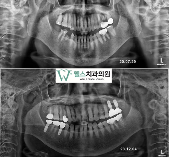 웰스치과의원개포 이미지