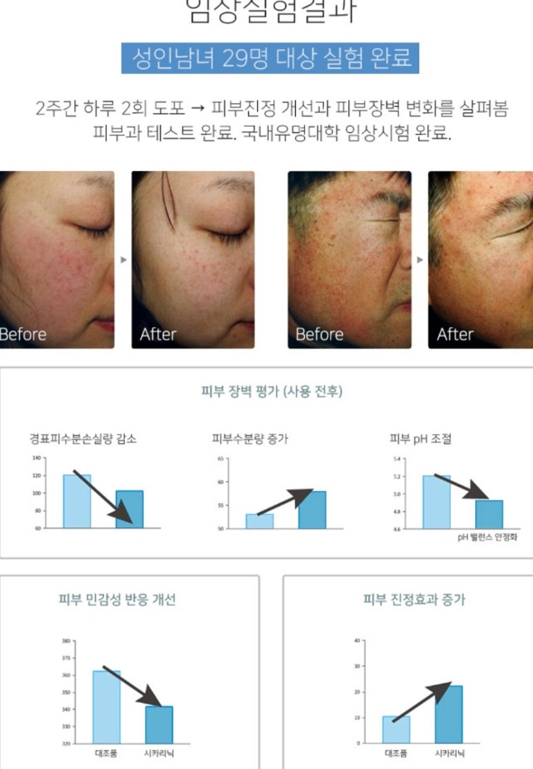 피에스엘 이미지