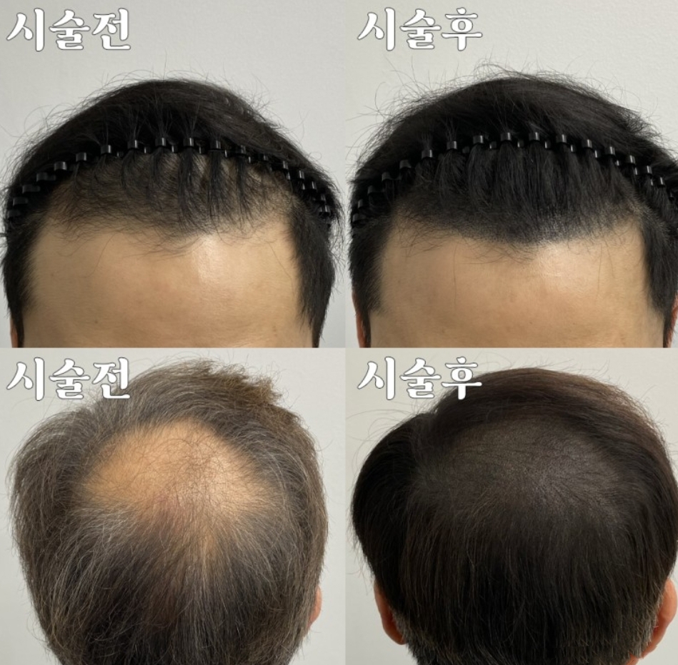 최창민헤어모드 이미지