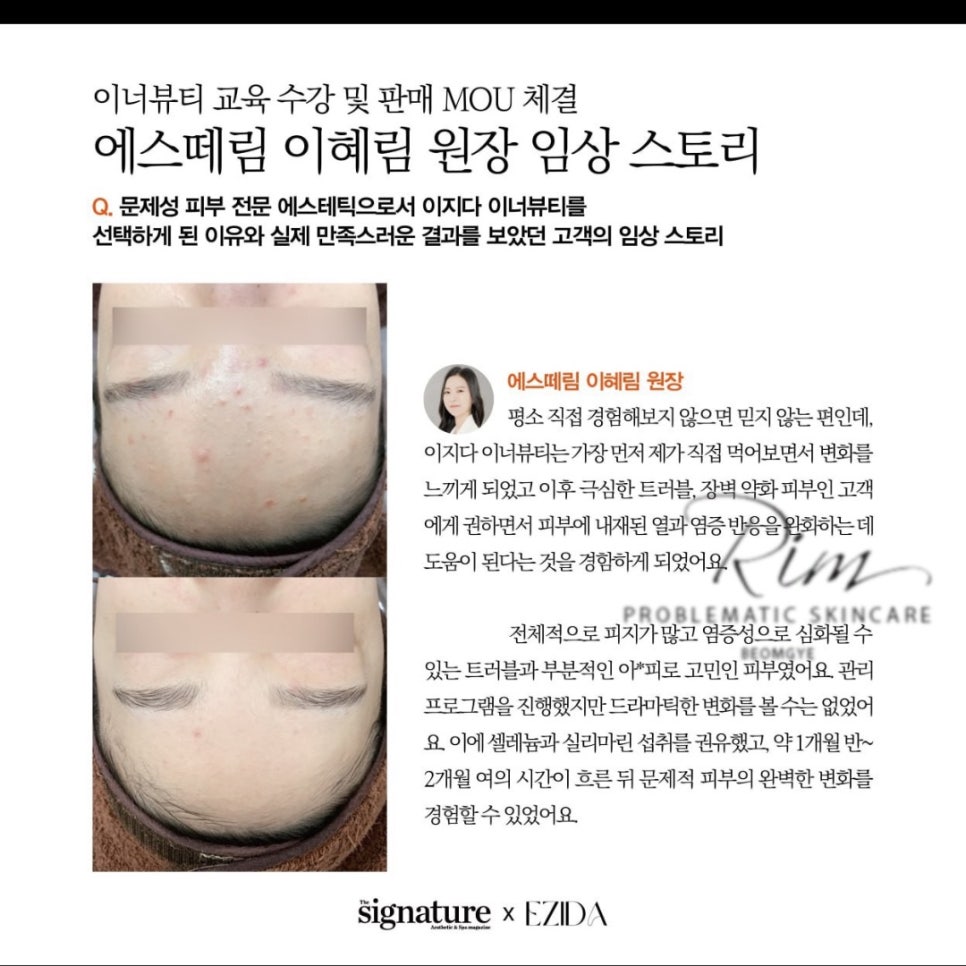 피부숨결 이미지