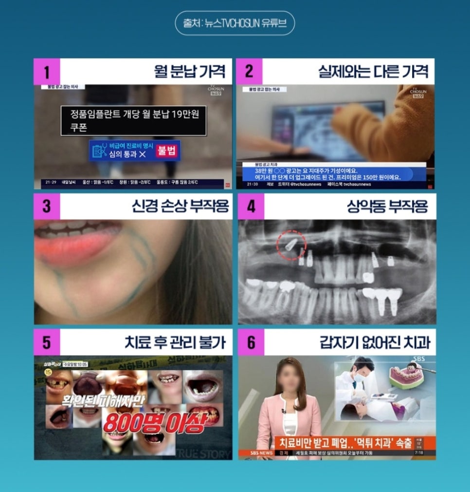 강남애프터치과 이미지