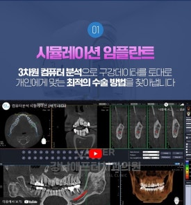 강남애프터치과 이미지