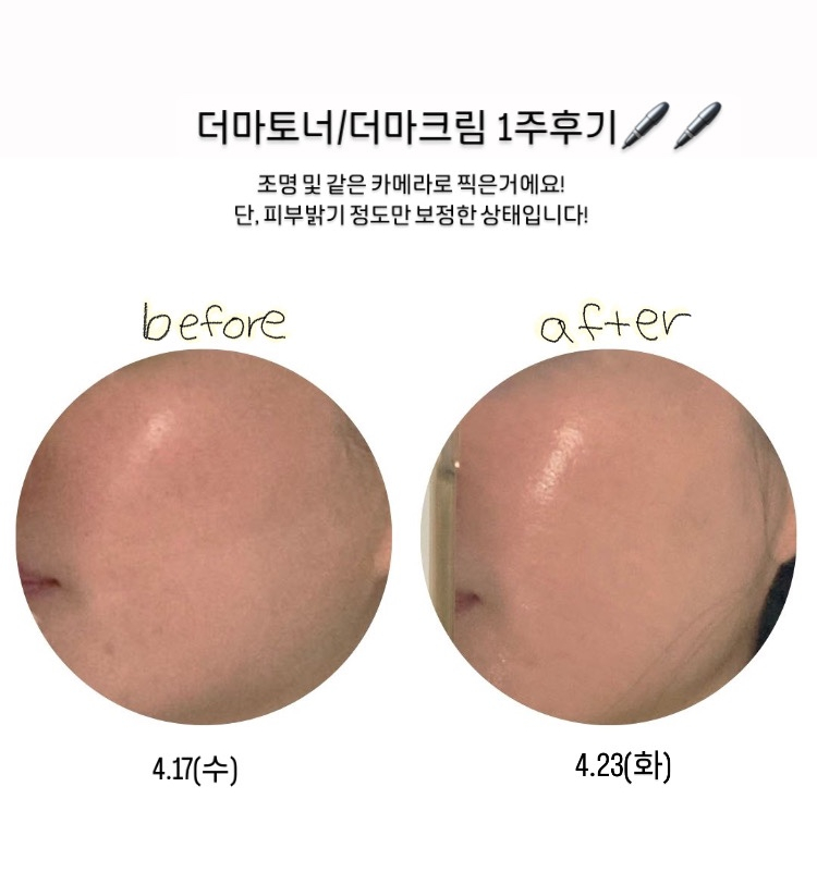 바이멜 이미지