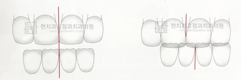 현치과교정과치과의원 이미지