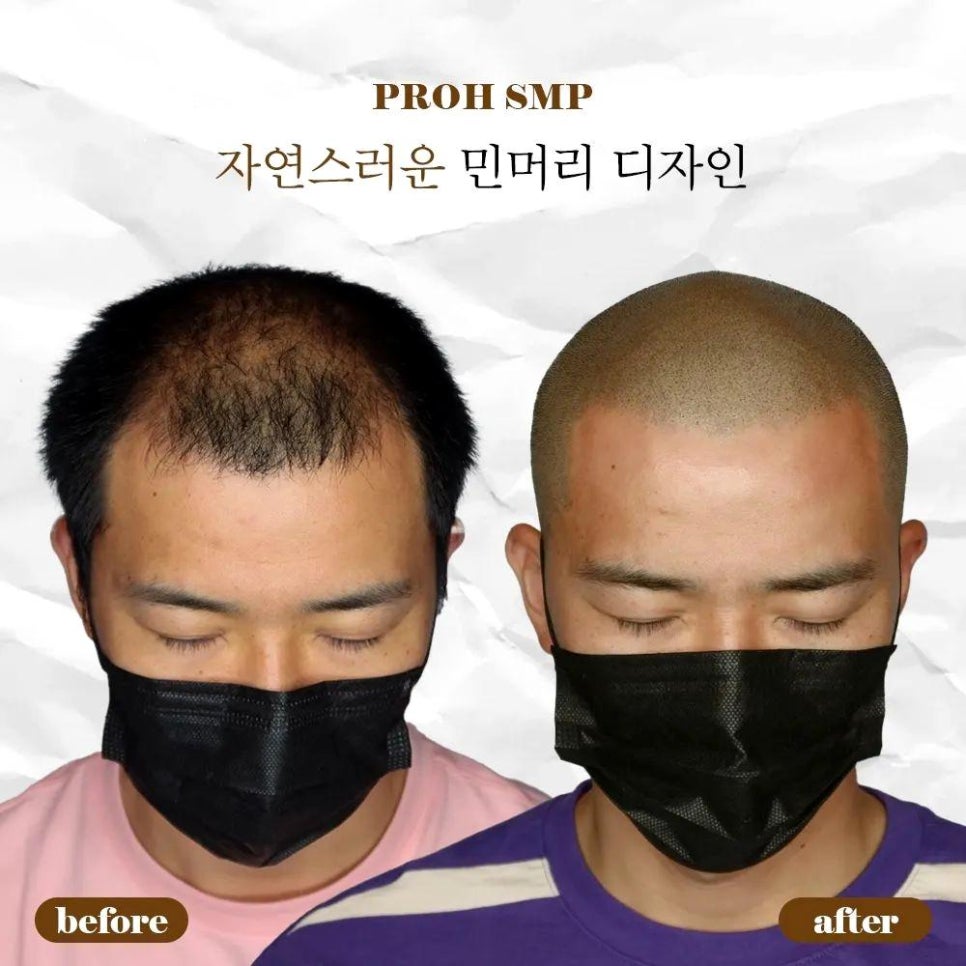 프로스칼프부산 이미지