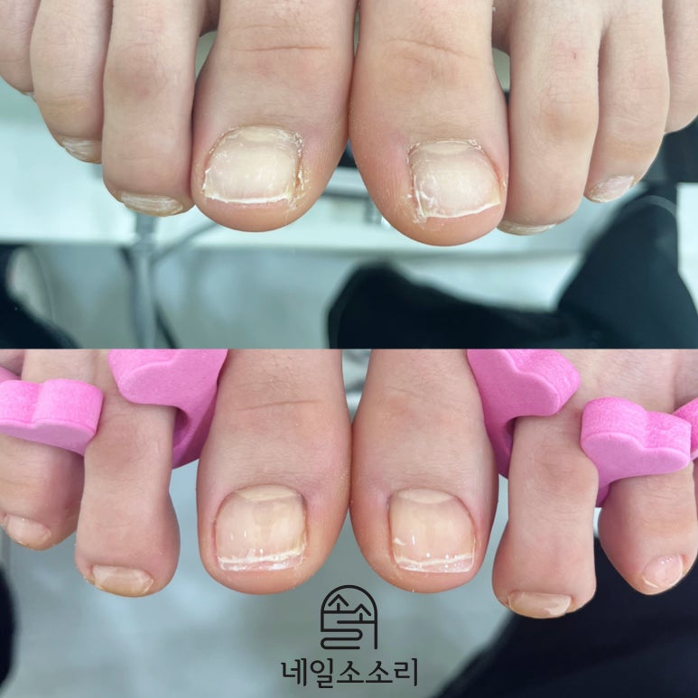 네일 소소리 이미지