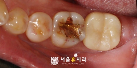 향치과의원 이미지