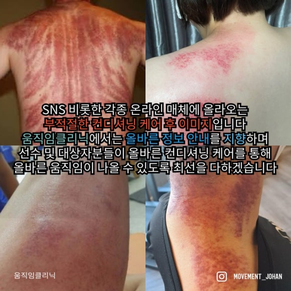 움직임클리닉 이미지