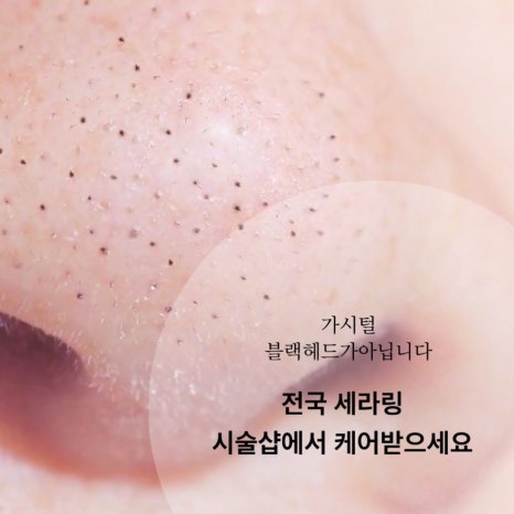 맑은스킨케어 이미지