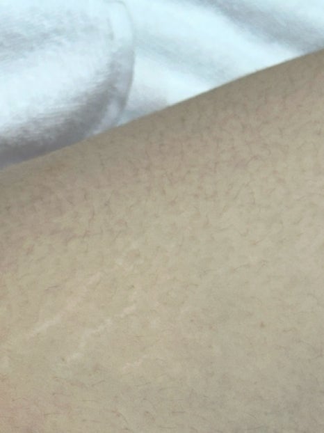 채우림뷰티 이미지