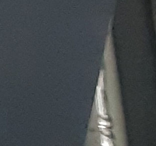 고려치과 이미지