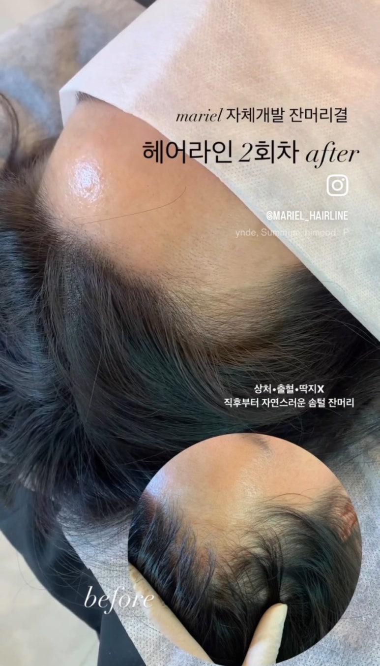 마리엘헤어 이미지