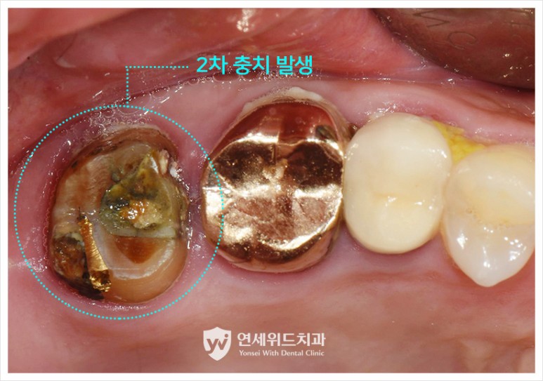 오포연세치과 이미지