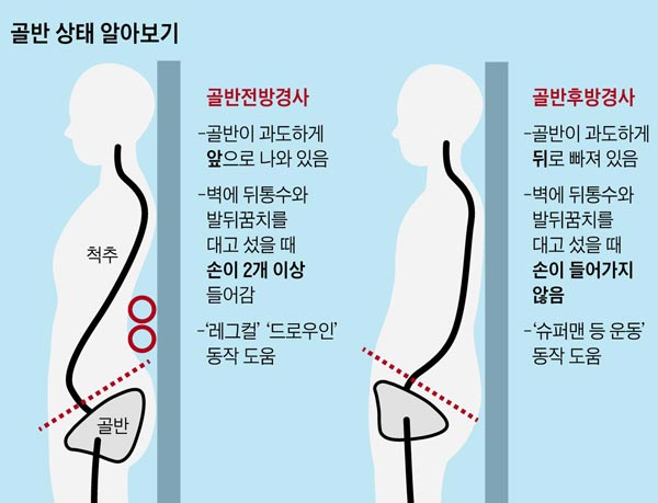 디오엠 이미지