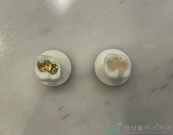 정성플러스치과 이미지