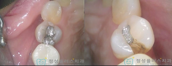 정성플러스치과 이미지