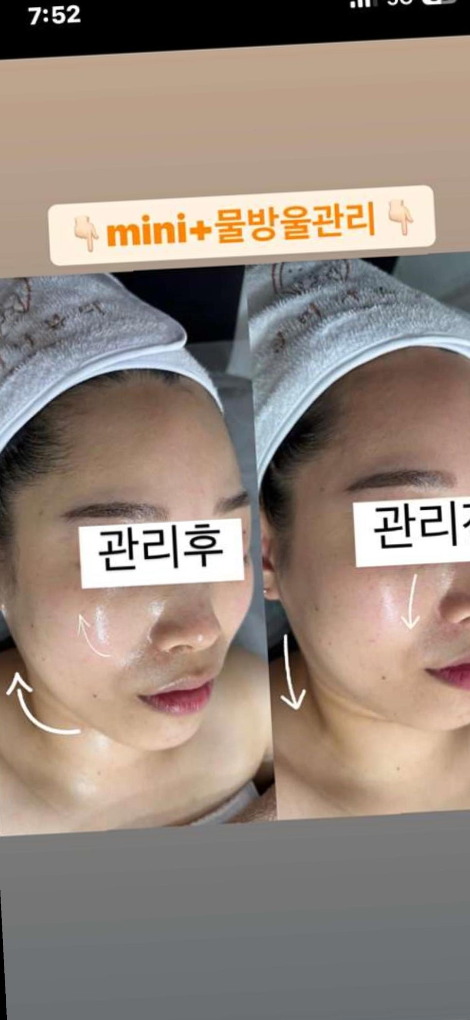 글리나뷰티 이미지