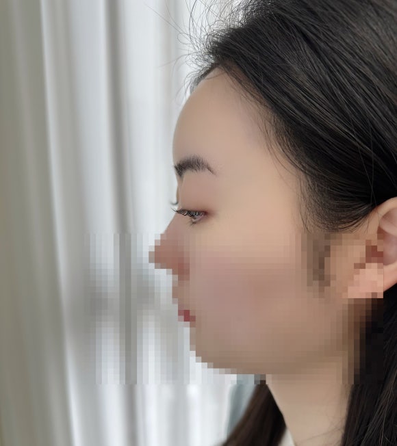 드바이래쉬 이미지