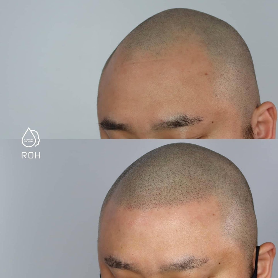 프로스칼프부산 이미지