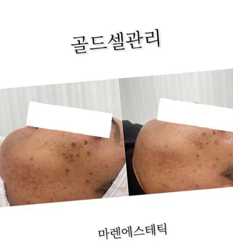 마렌에스테틱 이미지