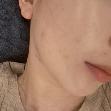 그린필스킨케어 이미지