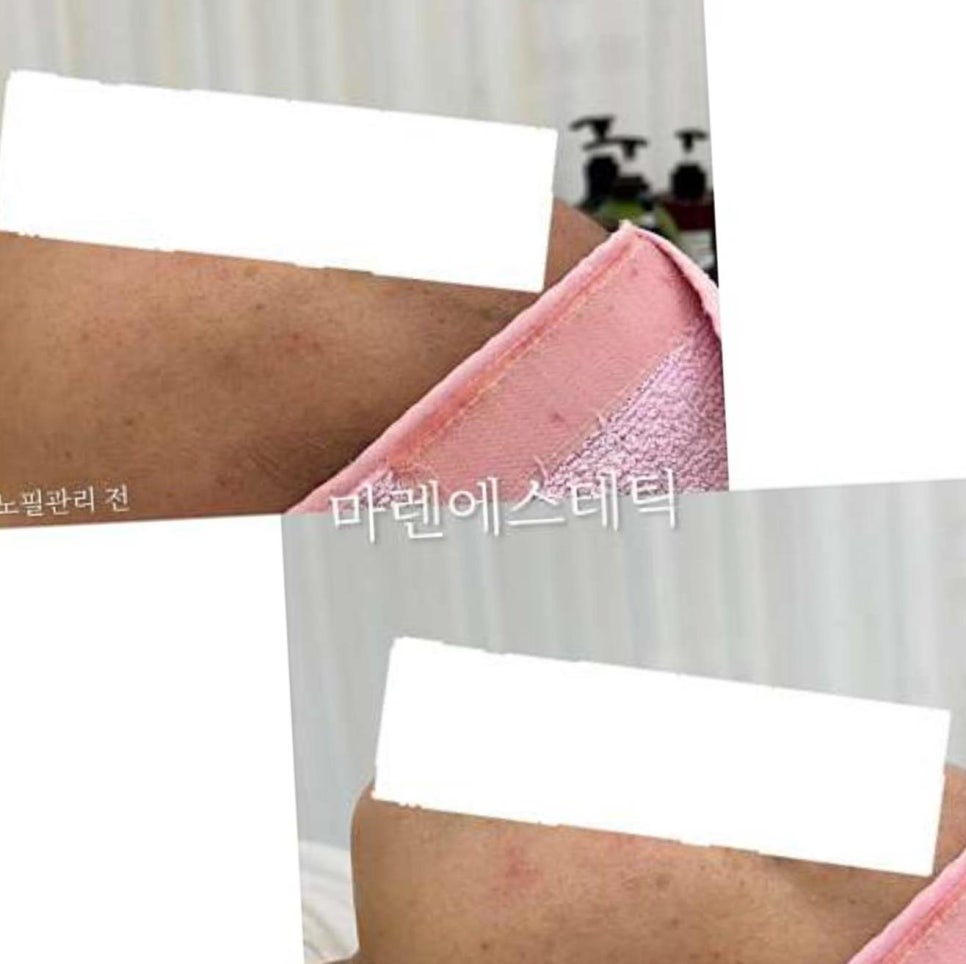 마렌에스테틱 이미지