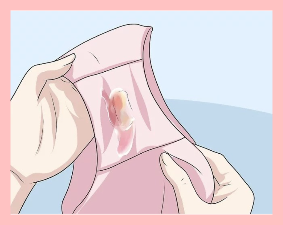 비너스산부인과 이미지