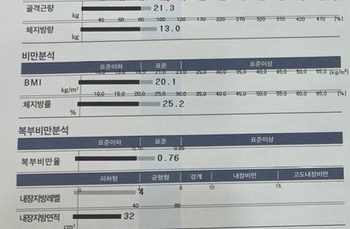 엑스날 목동 이미지