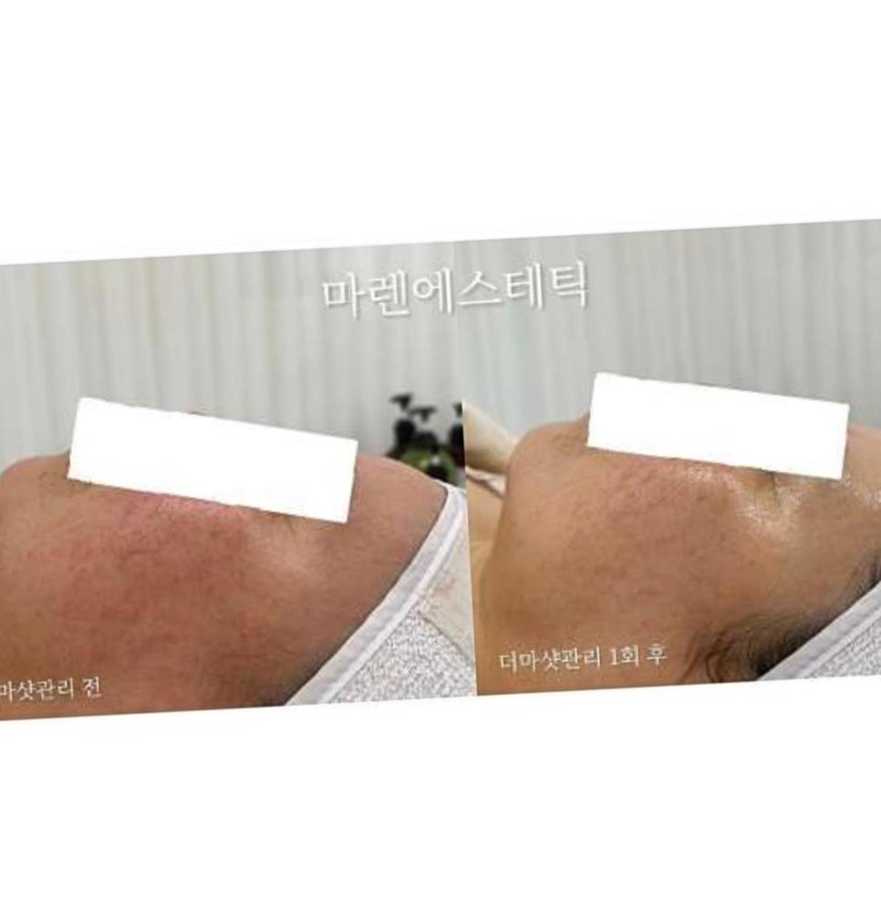 마렌에스테틱 이미지