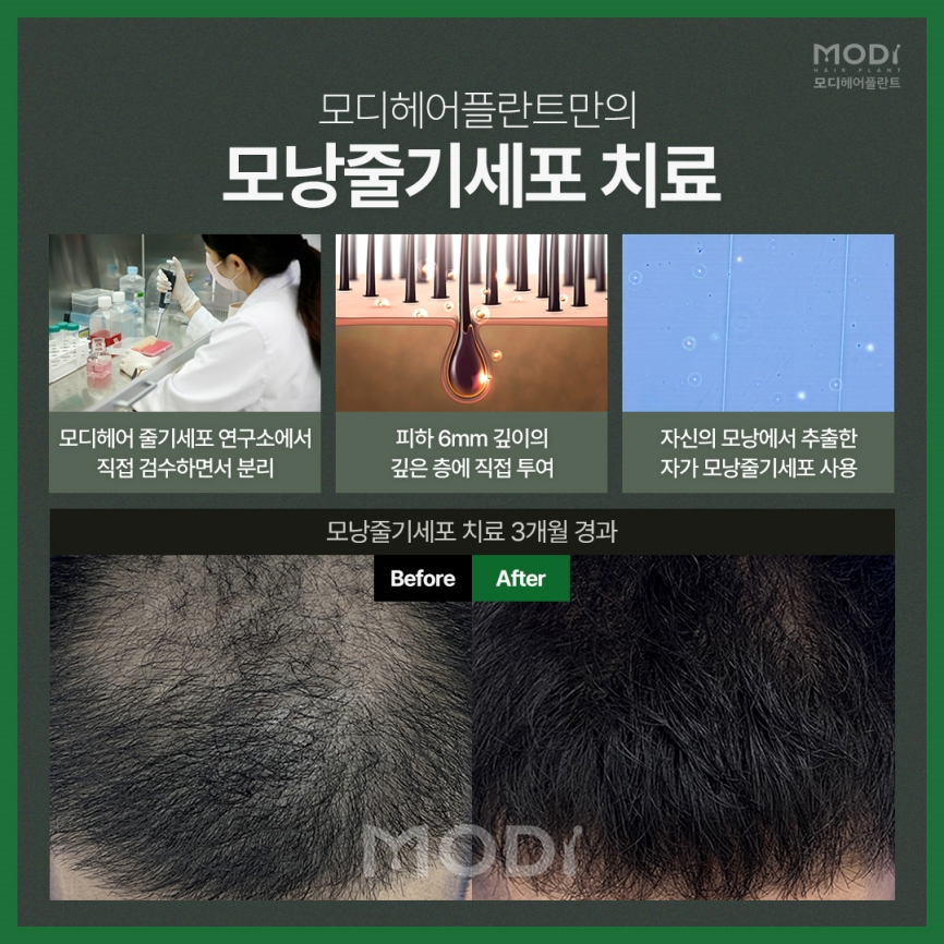 모디헤어 이미지