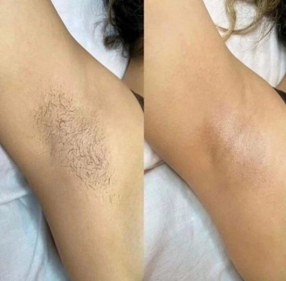 제이비비 이미지