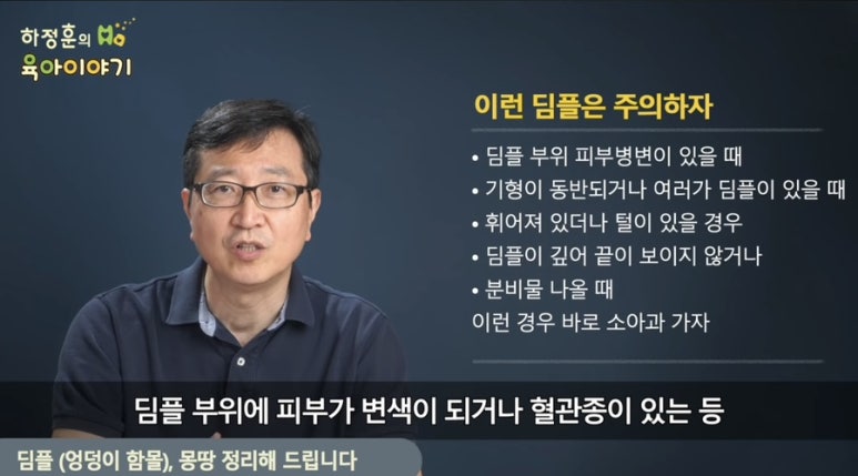 딤플 이미지