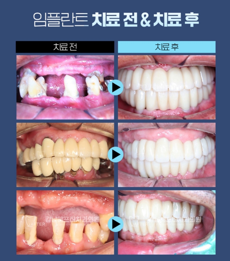 강남애프터치과 이미지