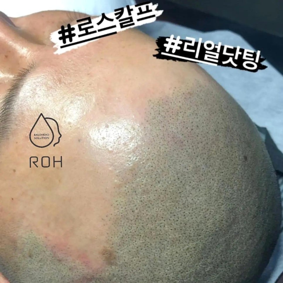 프로스칼프부산 이미지