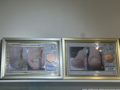 결네일닥터아이티엔네일 이미지