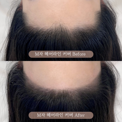 헤어달 이미지