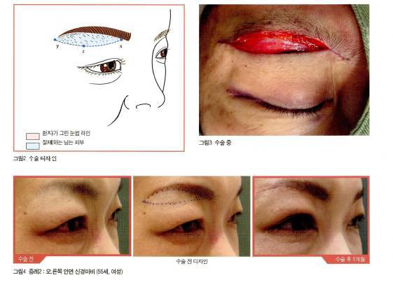 가본의학주 이미지
