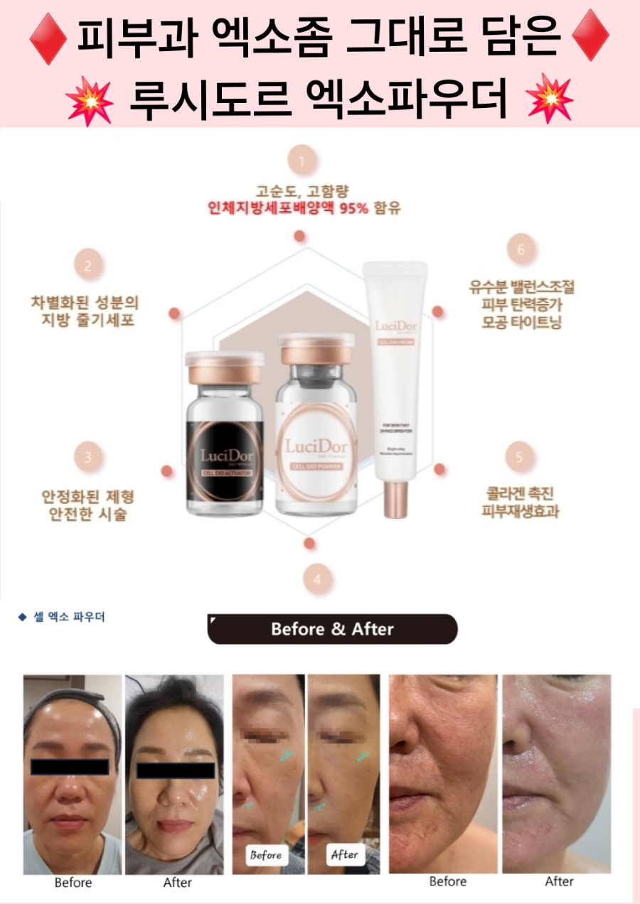 상분이스킨 이미지