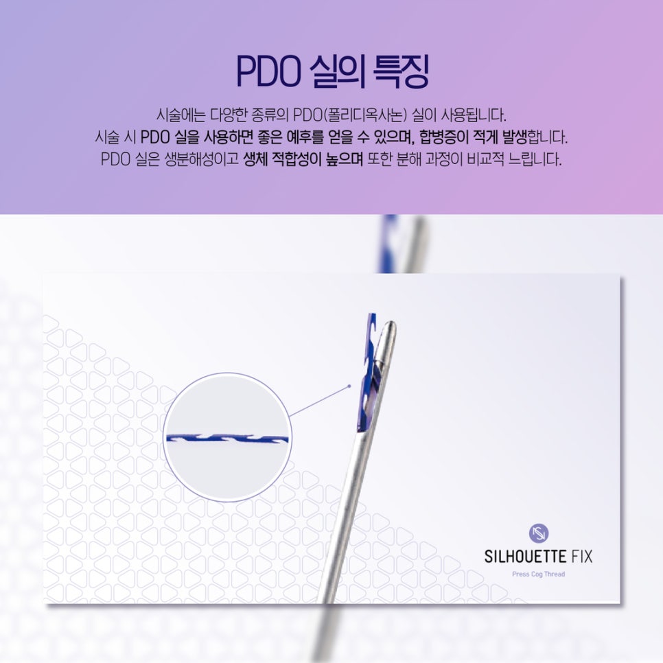 신비성형외과 이미지