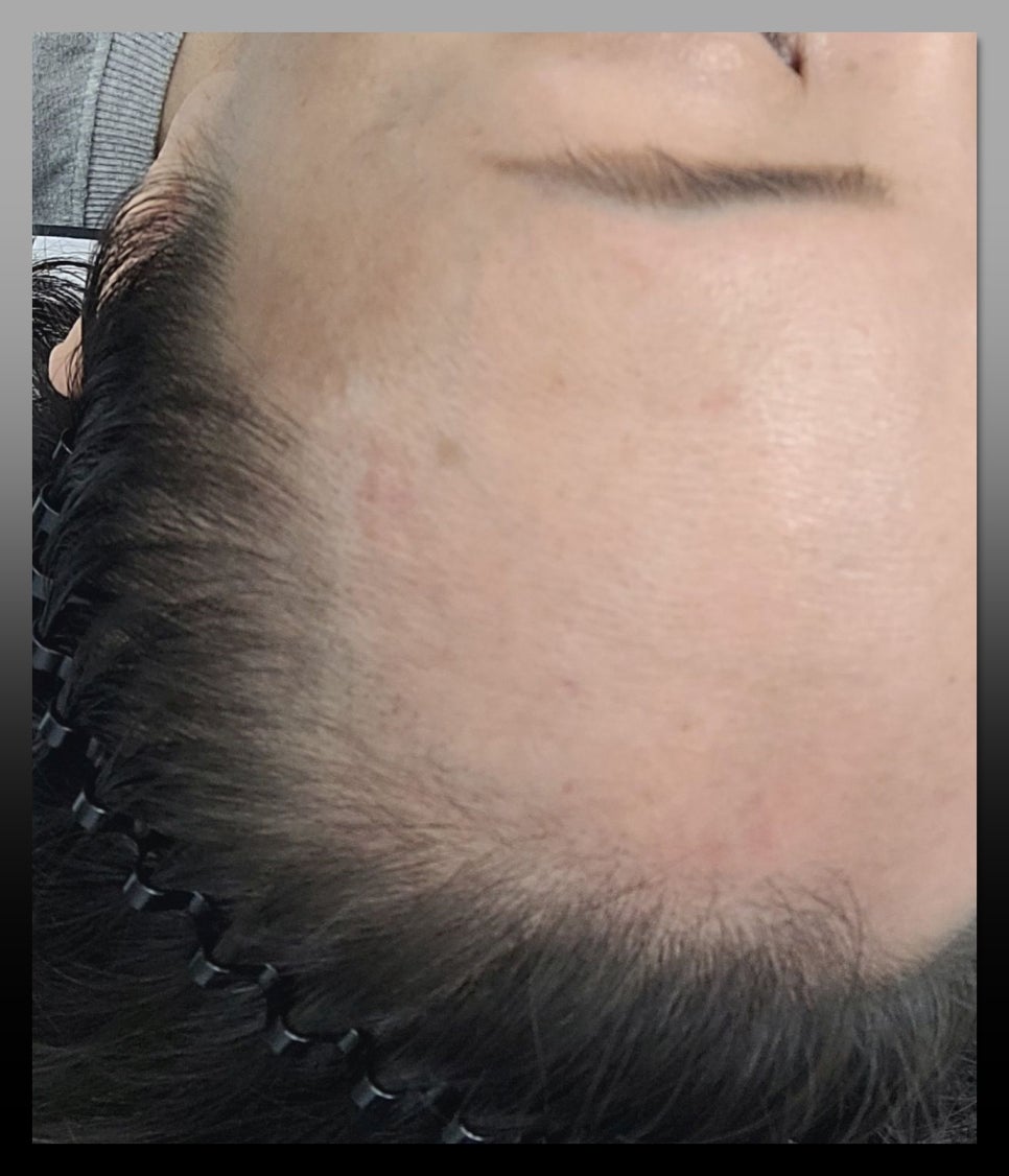 제이제이스칼프 이미지