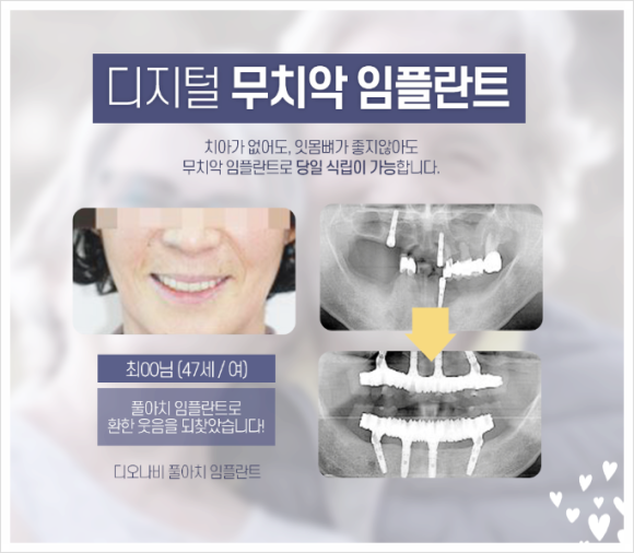 연세예일치과 이미지