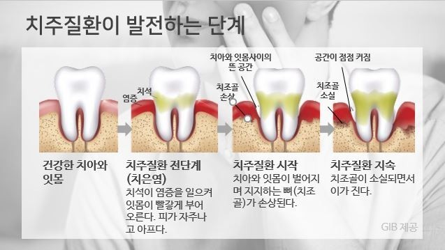 박앤박 이미지