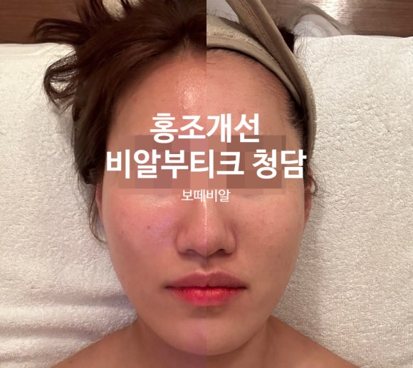 비알부티크 이미지