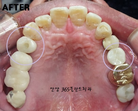 지오크라운 이미지
