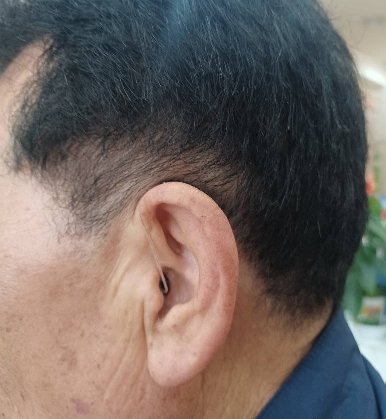 독일보청기 진영센터 이미지