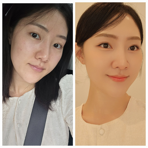 조이 187 더링크 이미지