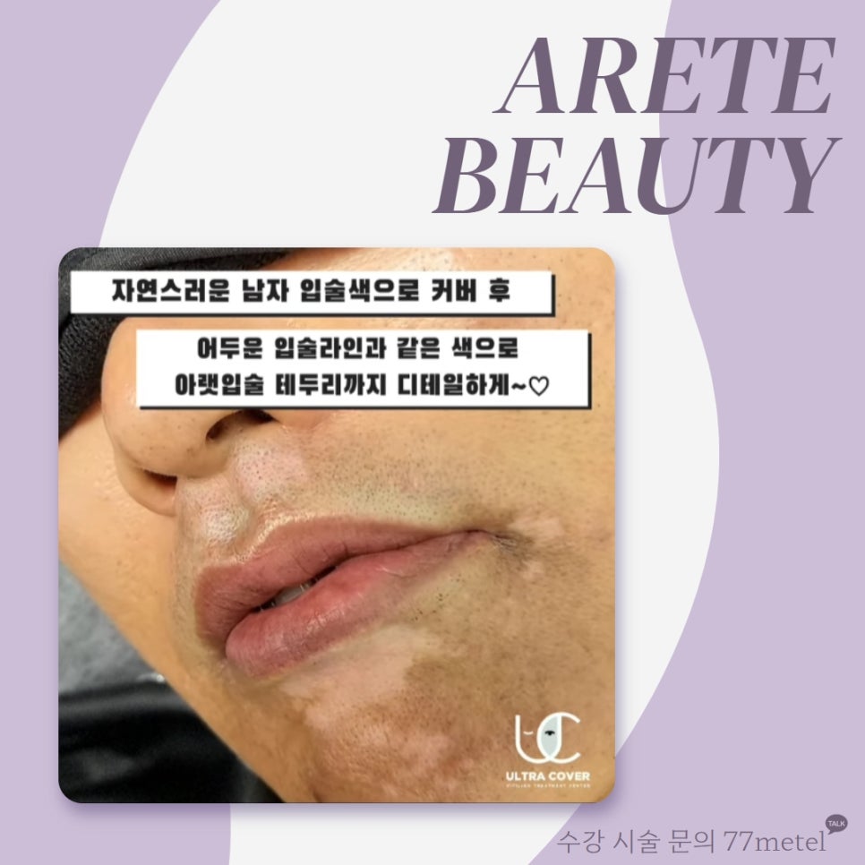 52아레테 이미지