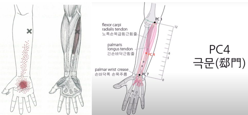 근육학과 경혈학 29 ; 수장장근과 극문혈 : 네이버 블로그